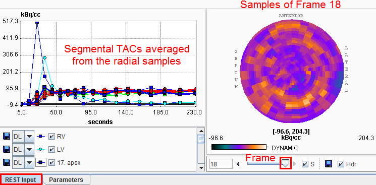 PCARD Radial Sampling Polar Plot